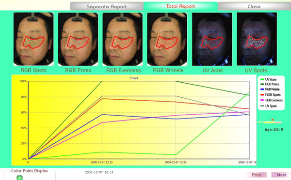 Hot sale intelligent skin analyzer machine with high resolution