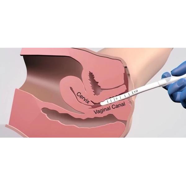 2 In 1 RF Beauty Machine for female intimate areal Tighten Labia Tighten Vulva Rejuvenation and Beauty