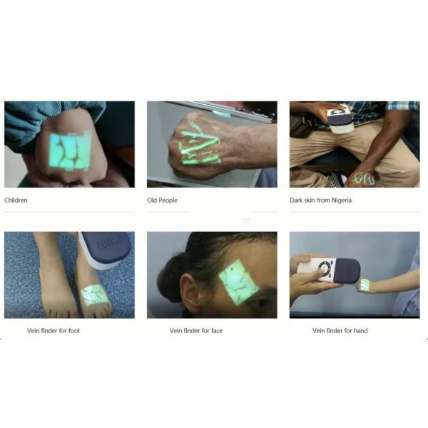 Máquina portátil de detección de venas médicas de 5V 15-25cm Rango 280g