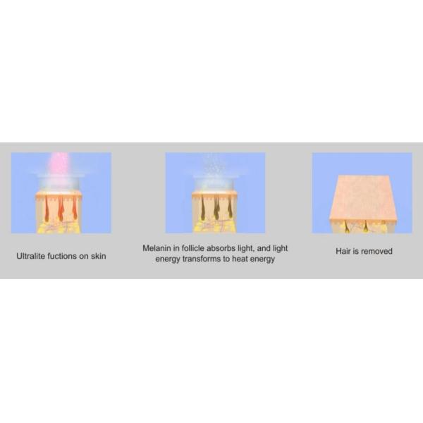 Vertical IPL Hair Removal Machine For Female Stationary Model 12 Hours Non Stop Flashing