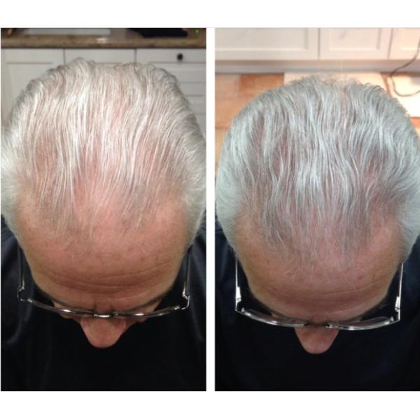 Hair growth oil