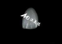 Estética natural Veneer EMAX muy resistente a la tinción Veneers cerámicos EMAX
