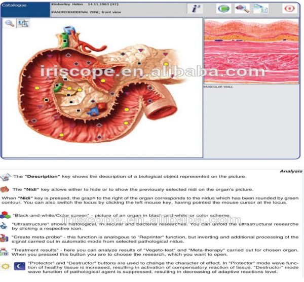 Spectrum of Minerals And Gems Treatment Metatron Nls 4025 Hunter for Cardiovascular Testing Equipment