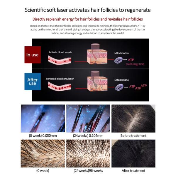 650nm 6 In 1 Laser Hair Growth Device For Scalp Care / Hair Regeneration