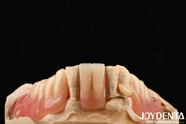 軽量 良質 生物互換性 アクリル歯科 医療機器のパーソナライズされたパーソナライゼーション