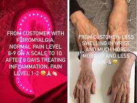 FDA 8W Flexible Pain Relief Infrared Red Light Therapy Pad With 152pcs LED
