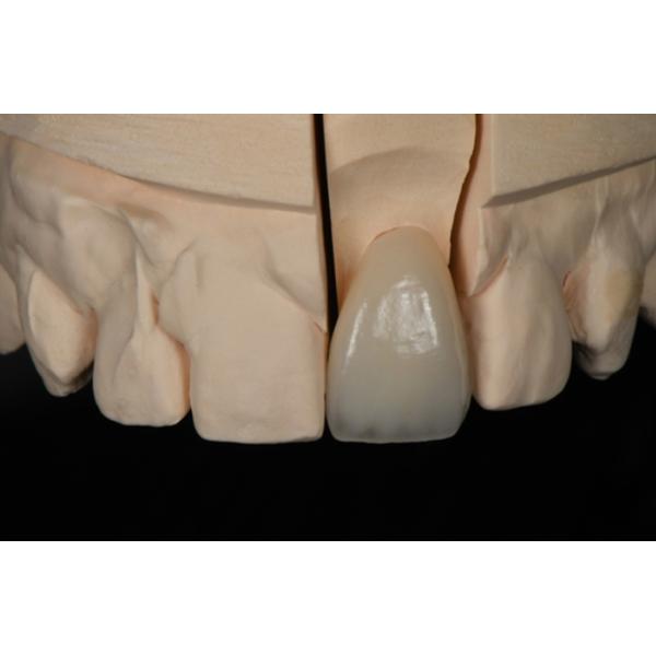 1200HV Anterior имплантируют разнослоистый диск UT Zirconia для зубоврачебной лаборатории Wecera