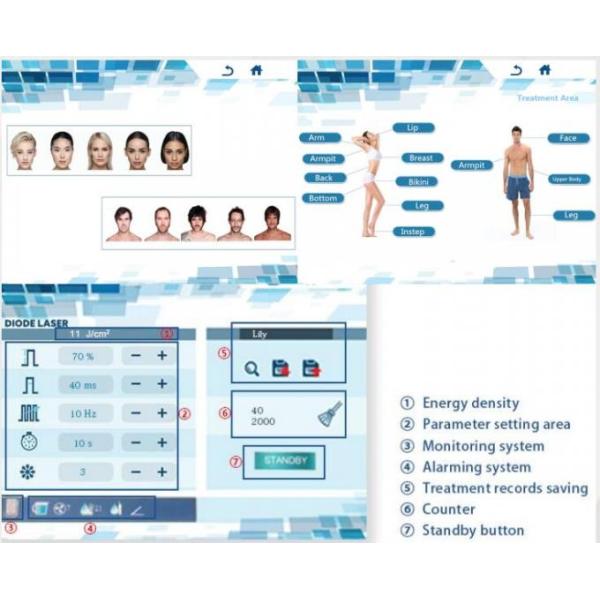 20 Million Shots Lady Hair Removal Machine 800W Power 10HZ Frequency