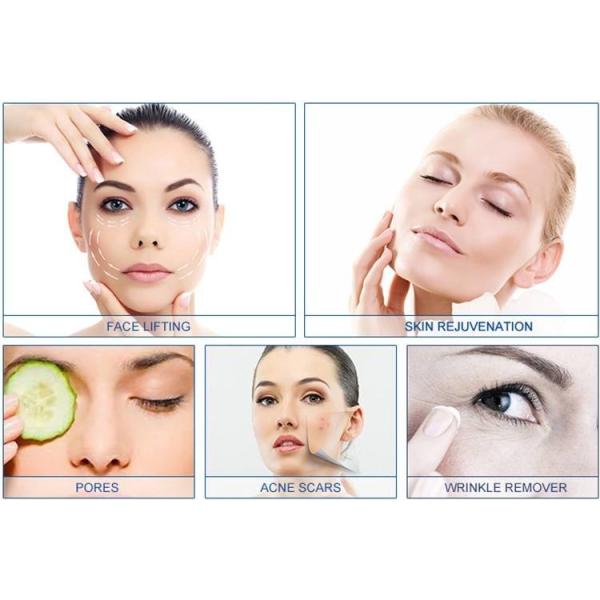 Машина подмолаживания SRF кожи машины Pin RF Microneedling MRF 81