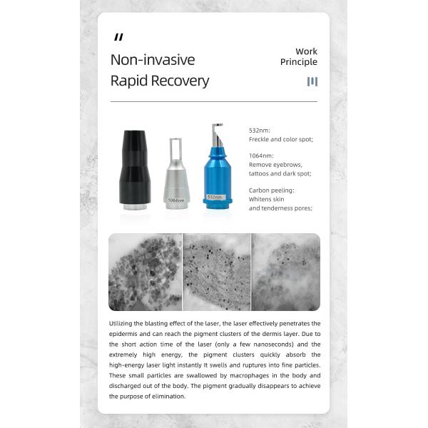 Q Switched 1064nm Yag Laser Machine Tattoo Removal Portable