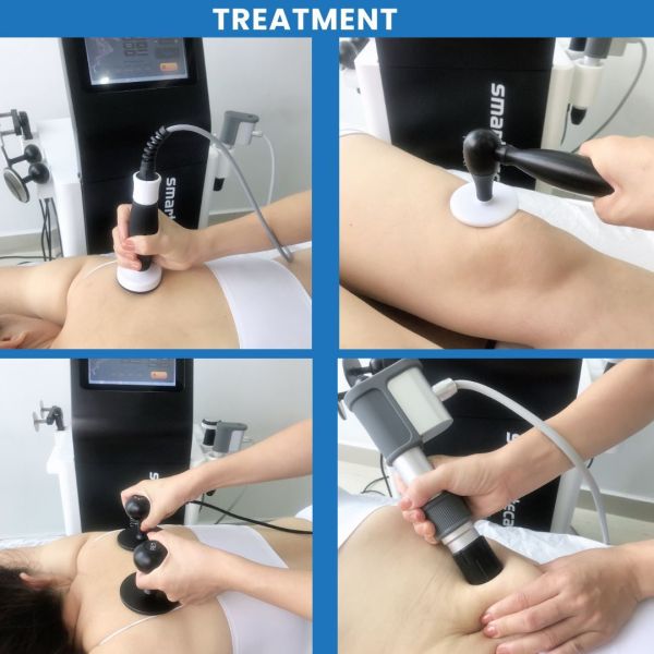 Smart Tecar 3 In 1 Indiba Tecar Therapy Shockwave Ultrasound Physio Physiotherapy Machine For Back Pain Relief Weight Loss