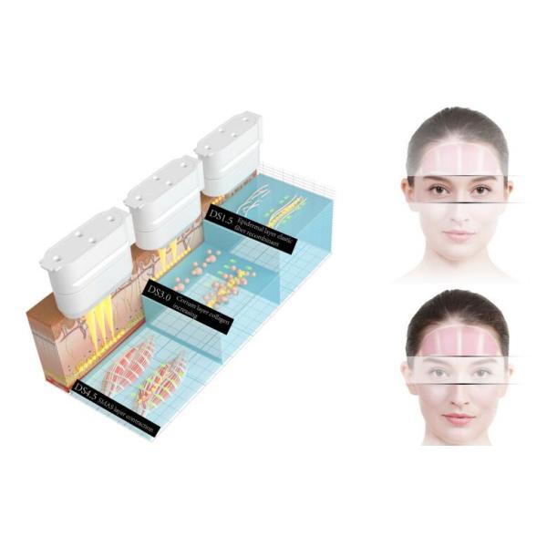 Home Use Portable American HIFU Facelift Machine skin lifting