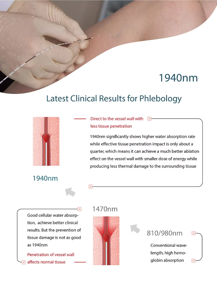 1940nm Diode Laser For Varicose Vein Removal Varicose Veins Laser Machine EVLT 1940 Varicose Veins Laser Treatment
