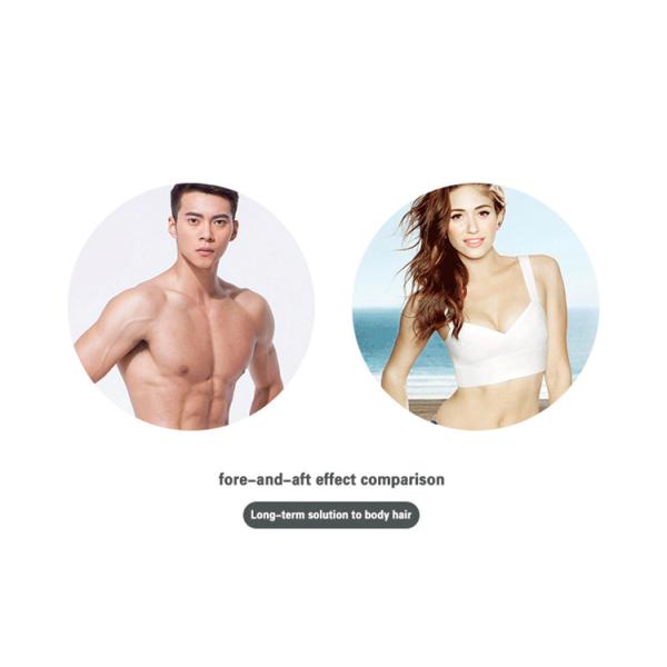 Portable Permanent Hair Removal Laser Machine