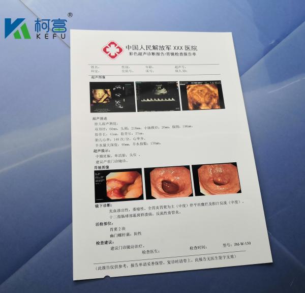 A4 B5 16K 125um White Glossy Inkjet X Ray Film Medical Dry Imaging Film