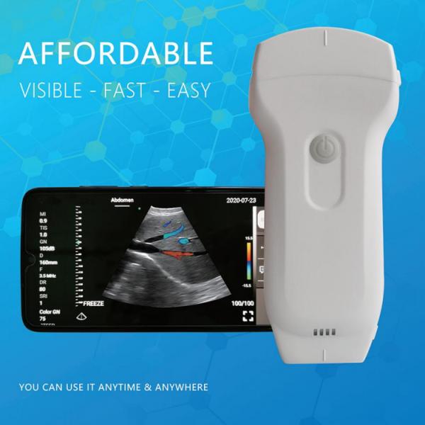 WIFI Wireless Color Probe GYN Ultrasound Linear Probe With Display Anesthesia Puncture Navigation Handheld Ultrasound