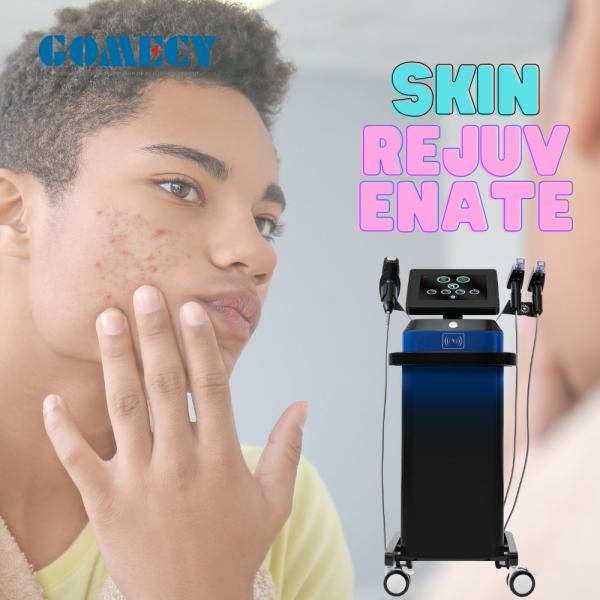 GOMECY Фракционная обработка кожи с помощью микроигловой радиочастотной машины для безопасного удаления морщин