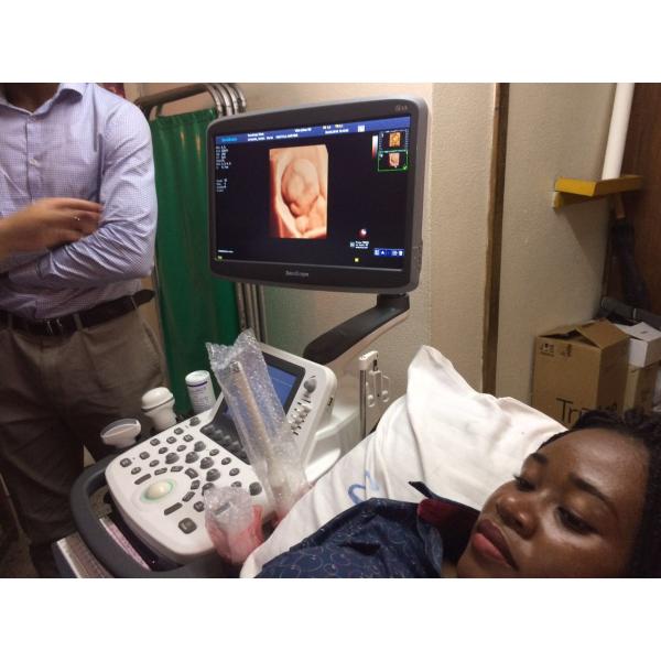 Stock SonoScape S22 ultra 5G Ultrasound Machine, Wireless Ultrasound for Veterinary Ultrasound Diagnosis