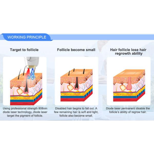 Semiconductor 808 Diode Laser Hair Removal Machine With CE Approved