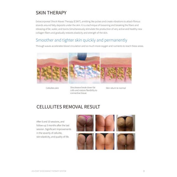 Portable Shockwave Therapy Machine Precision with 1-6.0 Bar Energy Levels