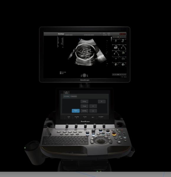 13.3 Inch LCD Trolley SonoScape Ultrasound Machine P60 AI Based