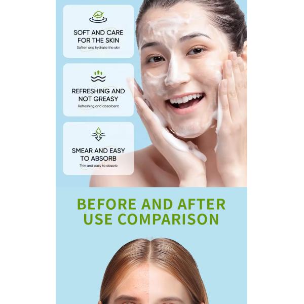 Nettoyant moussant pour le visage, éliminateur de points noirs, anti-acné, soin pour peau sèche, contrôle du sébum