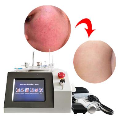 6 In 1 Spider Vein Laser Machine , 980nm Face Vascular Treatment Varicose Veins Machine