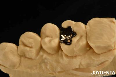 Clinical Metallic Dental Gold Crown 60K Gold Tooth Cap For Oral Rehabilitation