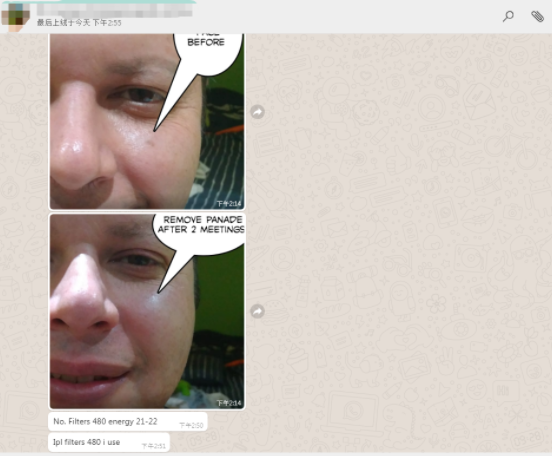 640nm 560nm SHR Permanent Hair Removal Machine For Home Use