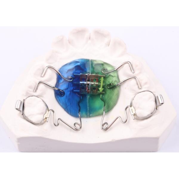 FDA Pendulum Appliance Orthodontics Pendulum Ortho Appliance Customizable