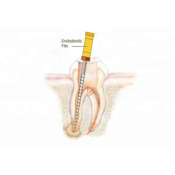 Файлы пути Niti Endo роторные