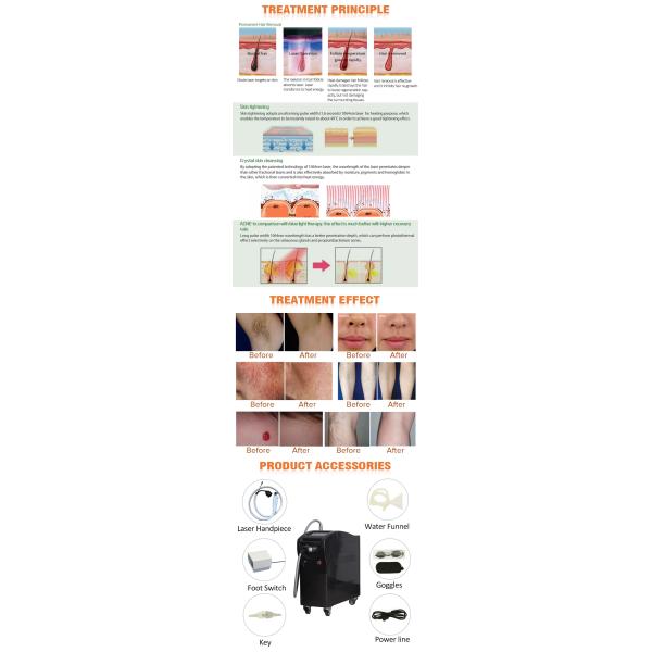 оборудование удаления волос на лице машины лазера Alexandrite 755nm 1064nm для салона красоты