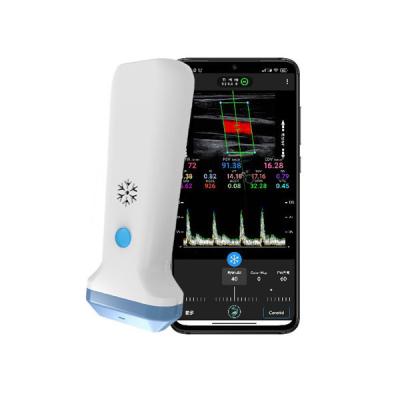 Linear Probe Wireless Ultrasound Machine Portable 4MHz 8.3MHz 12MHz