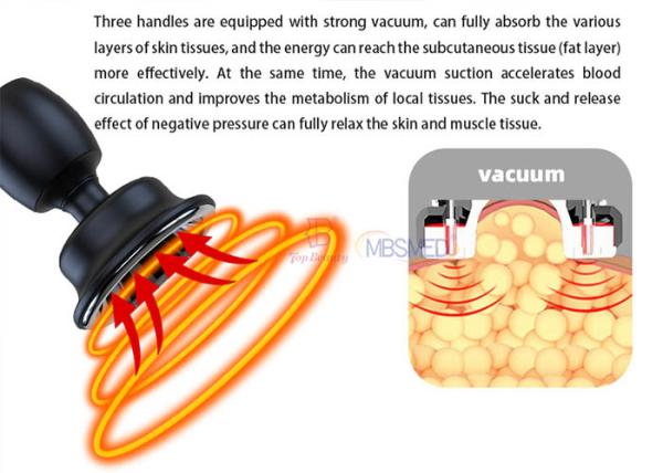 Vacuum Tecar Therapy Machine Ret Rf Lymphatic Drainage Pain Relief Machine