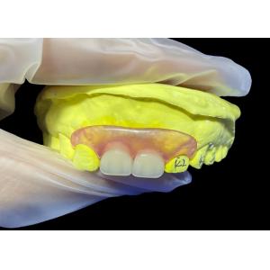 Специализированный безопасный, невидимый гибкий зубной протез для удобного жевания и речи.