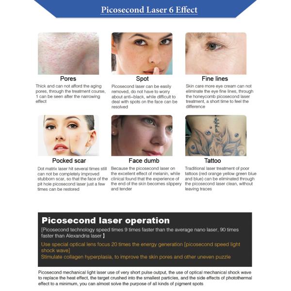 2000W Picosecond Laser Tattoo Removal Machine Q Switched Nd Yag Skin Rejuvenation