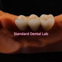 Couronnes de laboratoire dentaire numérique CAD CAM Translucide couronne en zirconium en couches