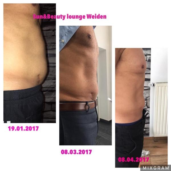 4-5cm fat lost after 1 treatment cryotherapy slimming machine with wind+water+semiconductor cooling system