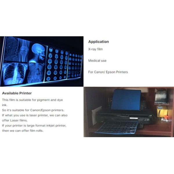 Печатная пленка для рентгеновских лучей А4 8х10 14х17 листов