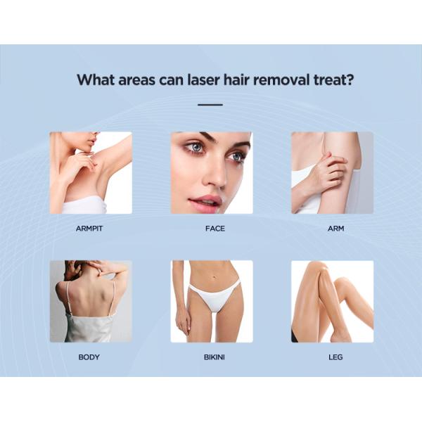 ADSS 755nm/808nm/940nm/1064nm Multiwaves Diode Laser Hair Removal Machine