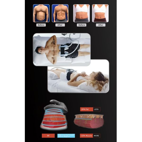 Desktop EMS Muscle Sculpting Machine , Compact RF Body Contouring Device For Beauty Studios