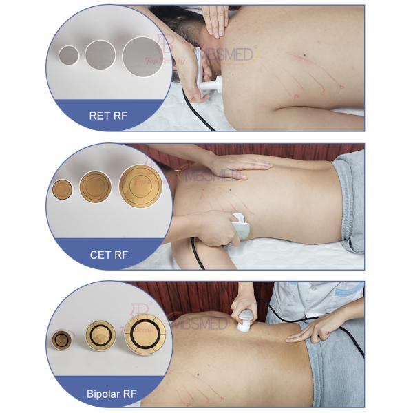 3 In 1 RET CET RF 448khz Tecar Therapy Physiotherapy Tecar Machine