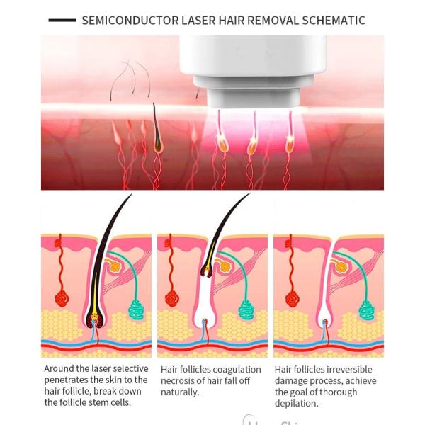 Оборудование красоты лазера диода 755 808 1064 подмолаживаний кожи удаления волос