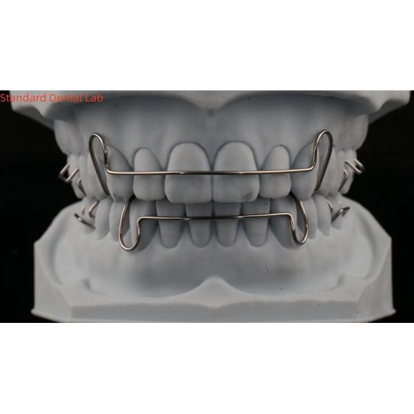 Comfortable Stainless Steel Acrylic Hawley Retainer Effective Orthodontics Appliance