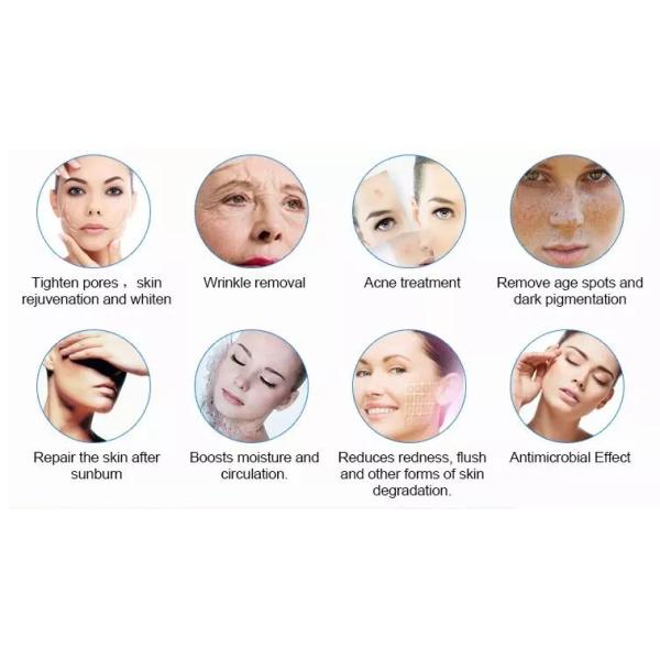 Машина терапией анти- морщинки фотодинамическая для обработки угорь/удаления пигмента