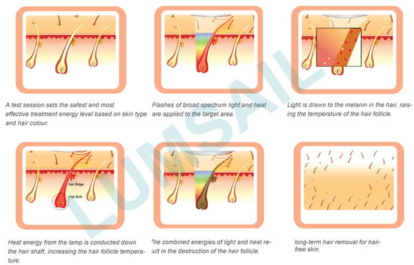 Касайтесь охлаждая машине удаления волос лазера ИПЛ/машине Реджунватион кожи безболезненным