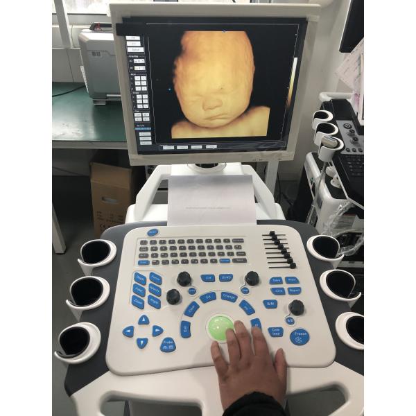 4D Color Doppler Ultrasound Machine Obstetrics And Gynecology Equipment Hospital