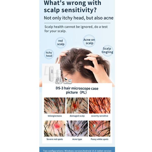 Hair And Scalp Analysis Machine , Skin Diagnosis Hair Analyzer Machine