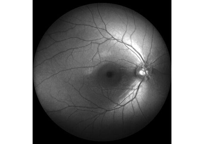 Оборудование камеры Fundus сканирования лазера профессиональное офтальмическое с Fundus отображая размер зрачка FOV 160° минимальный 2 mm