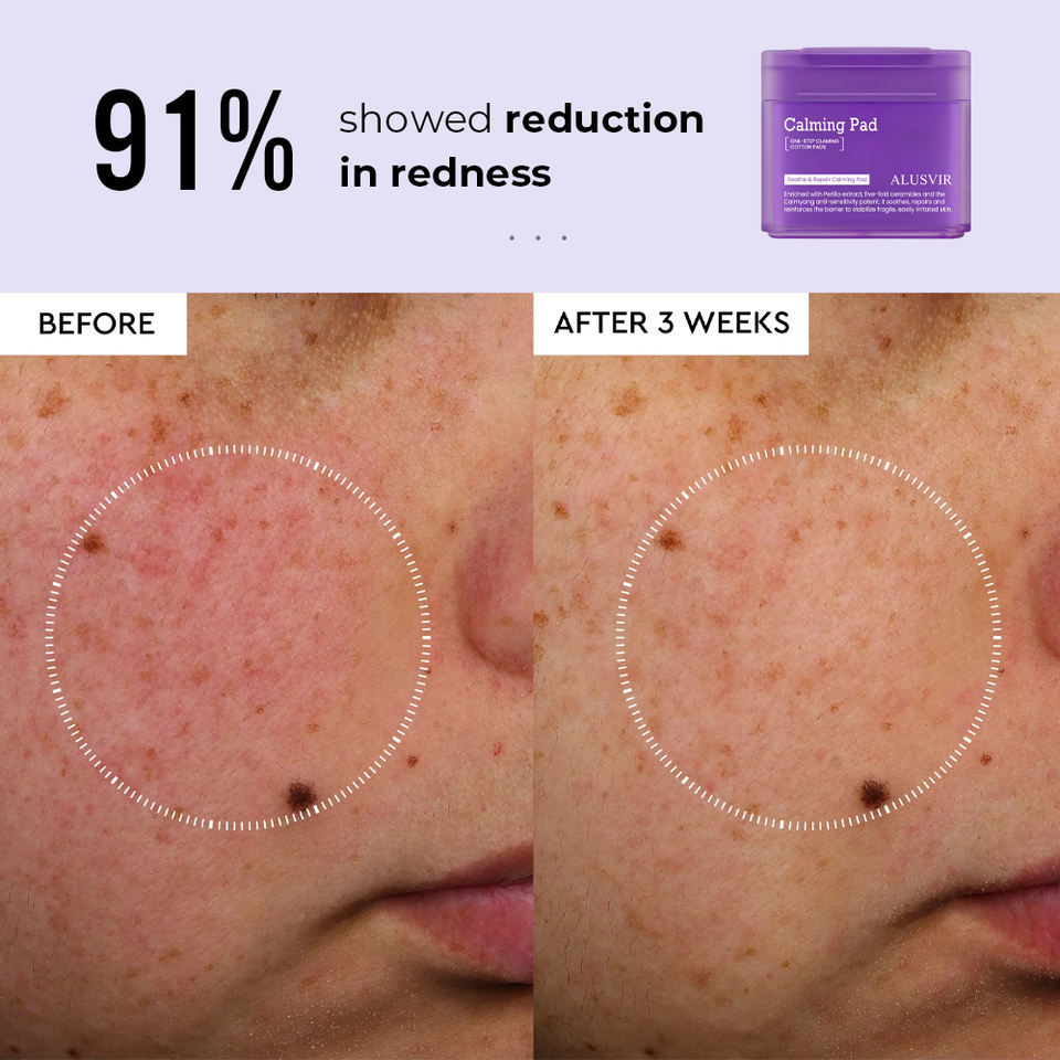 OEM ODM Brand Skincare Perilla Ceramide Soothing Hydrating Toner Facial Mask Hydrating Cleansing Pad Facial Mask